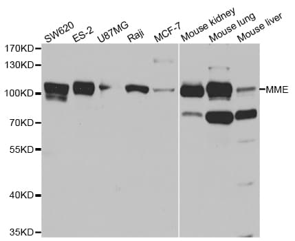 Polyclonal Rabbit anti-Human MME / CD10 Antibody (IHC, WB)