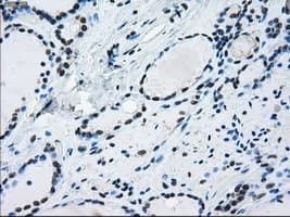ERCC1 Antibody (clone OTI1A3)