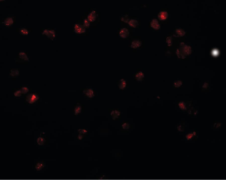 ZRP-1 / TRIP6 Antibody