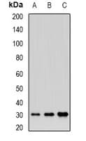 HSBLMHC1 / BTNL2 Antibody