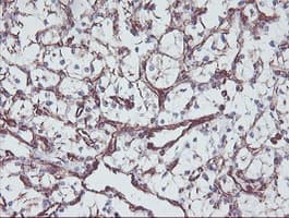 KIF2C / MCAK Antibody (clone OTI1C5)