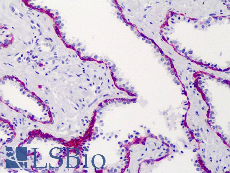 IHC-plus™ SDC1 / Syndecan 1 / CD138 Antibody