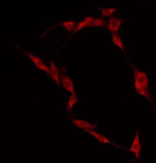 CLIP4 / RSNL2 Antibody
