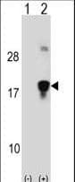 HMGN3 Antibody (aa1-30)