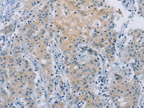 ZAK / MLTK Antibody