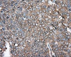 Monoclonal Mouse anti-Human DNTTIP1 / TDIF1 Antibody (clone OTI1F4, IHC, IF, WB)