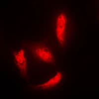 HDAC5 Antibody (Internal)