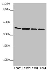 AKR7A2 / AFAR Antibody