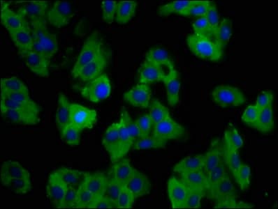 Polyclonal Rabbit anti-Human SLC11A1 / NRAMP Antibody (IHC, WB)