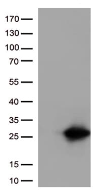 Monoclonal Mouse anti-Human CTAG1B / NY-ESO-1 Antibody (clone UMAB72, IHC, IF, WB)