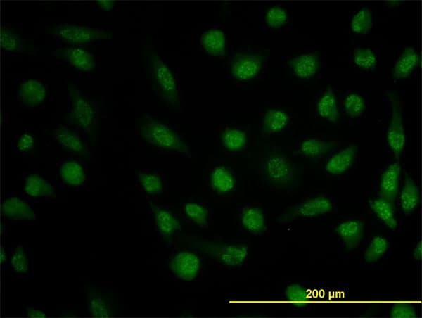 DHFR Antibody (clone 2B10)