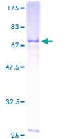 Human NCEH1 / AADACL1 Protein (Recombinant GST)