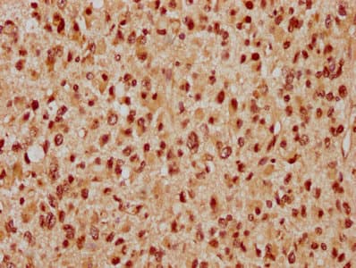 Polyclonal Rabbit anti-Human WAPAL / WAPL Antibody