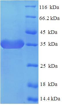 Human SIRPD Protein (Recombinant His-SUMO)
