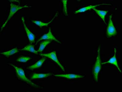 Polyclonal Rabbit anti-Human MX2 Antibody (IHC, IF)