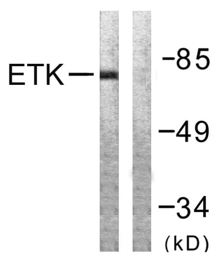 ETK / BMX Antibody (aa532-581)