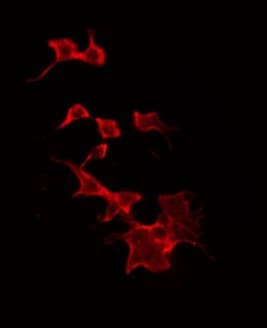 STMN1 / Stathmin / LAG Antibody