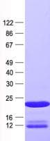 Human PIN4 Protein (Recombinant His, N-Terminal)