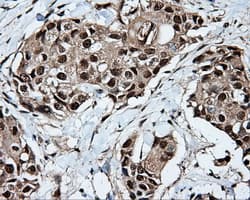 Monoclonal Mouse anti-Human TLDC1 / KIAA1609 Antibody (clone OTI5D9, IHC, IF, WB)