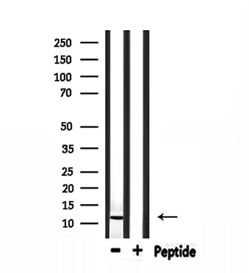 PVALB / Parvalbumin Antibody