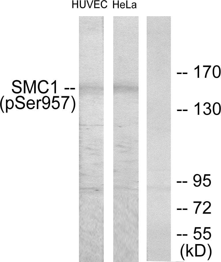 SMC1A / SMC1 Antibody (phospho-Ser957)