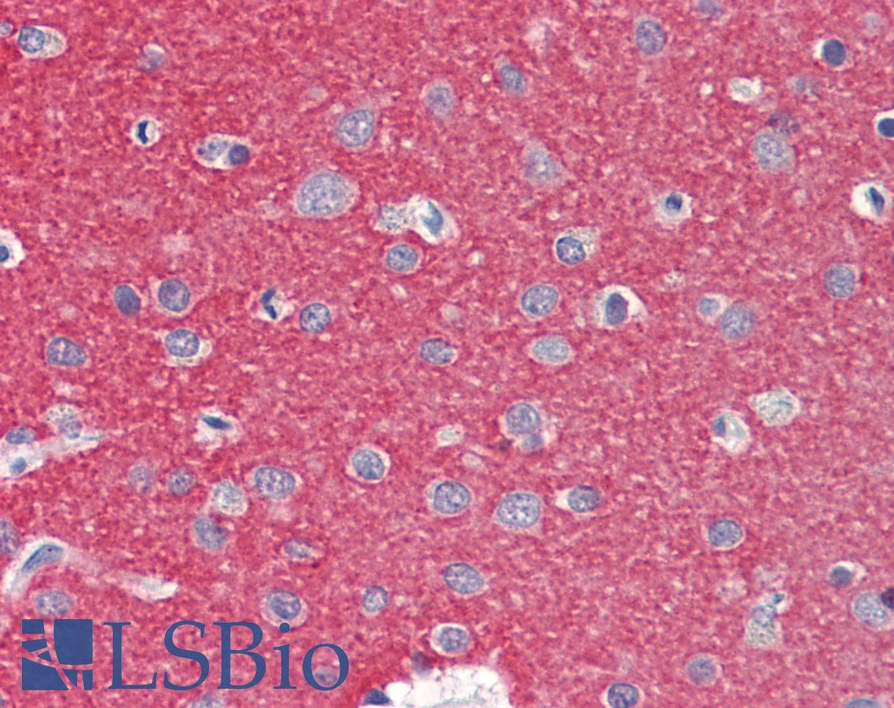 Polyclonal Rabbit anti-Human ZMYND15 Antibody (aa137-186, IHC, WB)