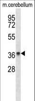 LMPB1 / PAQR8 Antibody (aa326-354)