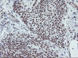 MLF1 Antibody (clone OTI3A3)