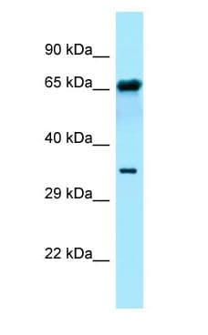 FPGT Antibody (aa357-406)