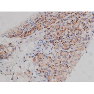 SYN / FYN Antibody (phospho-Tyr530)