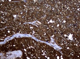 NME1 / NM23 Antibody (clone OTI2A5)