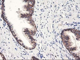 HARS2 Antibody (clone OTI6F9, Carrier-free)