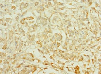 TTLL2 Antibody