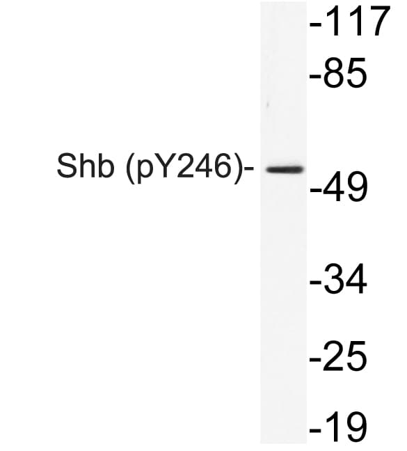 SHB Antibody (phospho-Tyr246)
