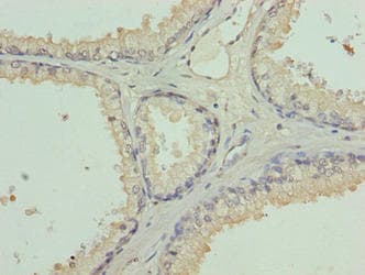 L3MBTL4 Antibody