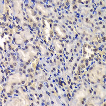 DDX41 / ABS Antibody