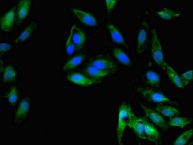 Polyclonal Rabbit anti-Human IL8 / Interleukin 8 Antibody (IF)