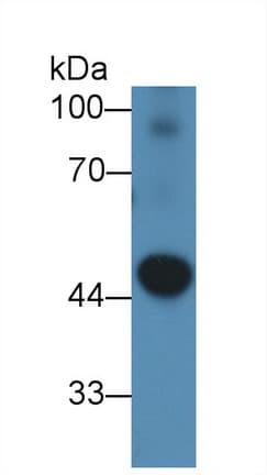 PDK2 Antibody (aa155-379)