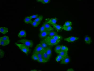 IHC-plus™ Polyclonal Rabbit anti-Human TNF Alpha Antibody (aa77-233, IHC, WB)