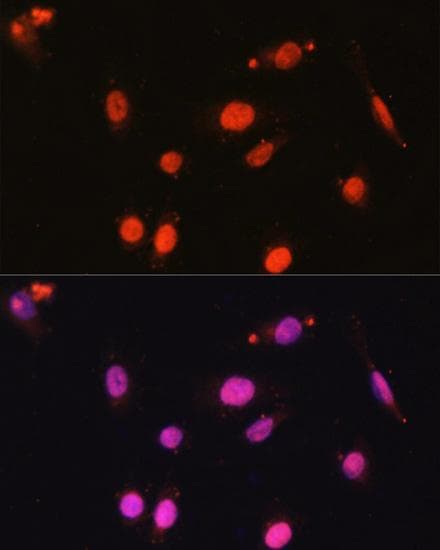 DDX17 Antibody