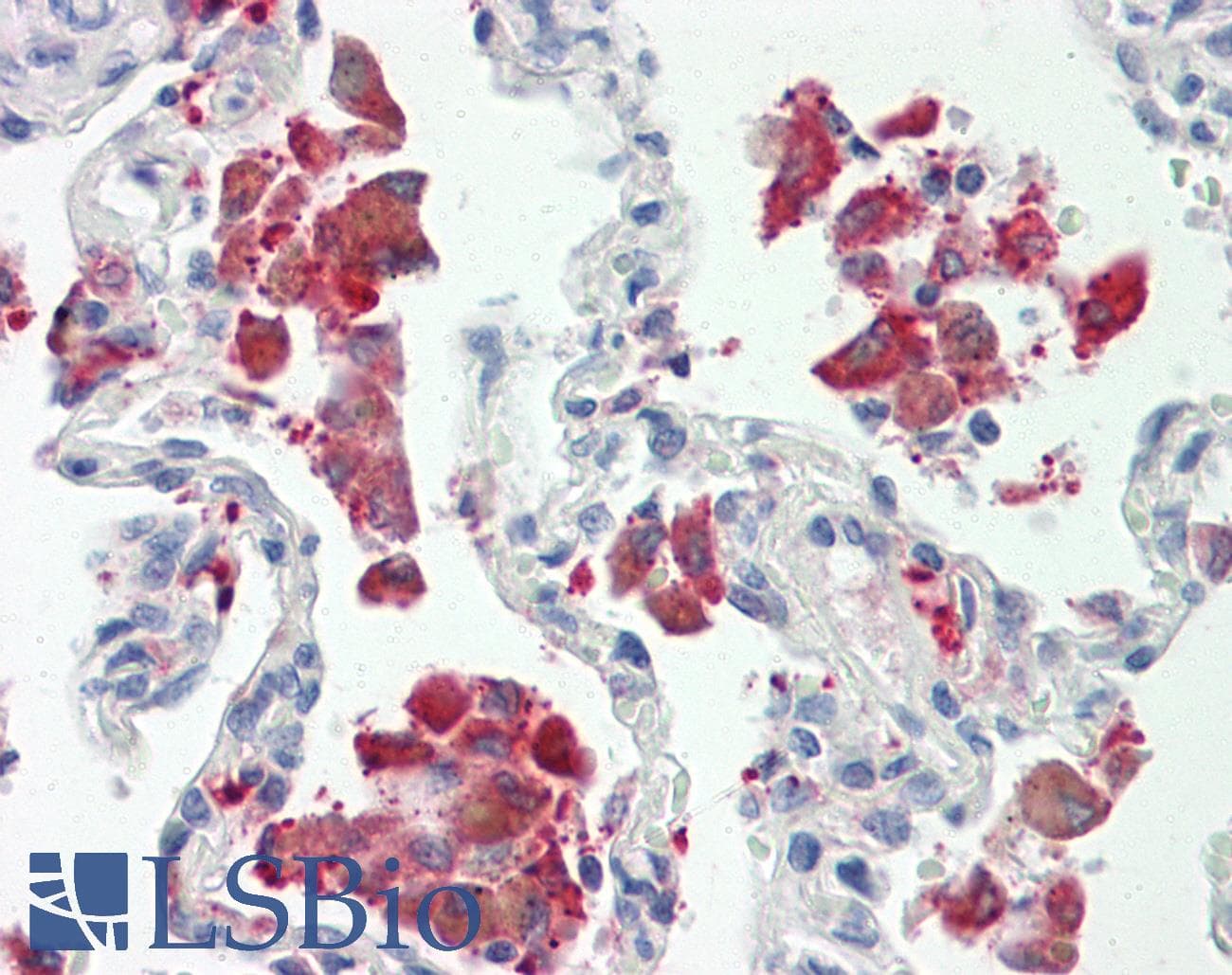 IHC-plus™ ZNF608 Antibody (aa1231-1280)