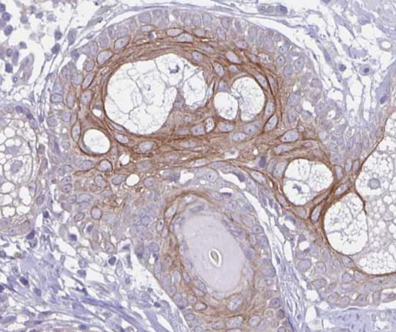 NPBWR2 / GPR8 Antibody