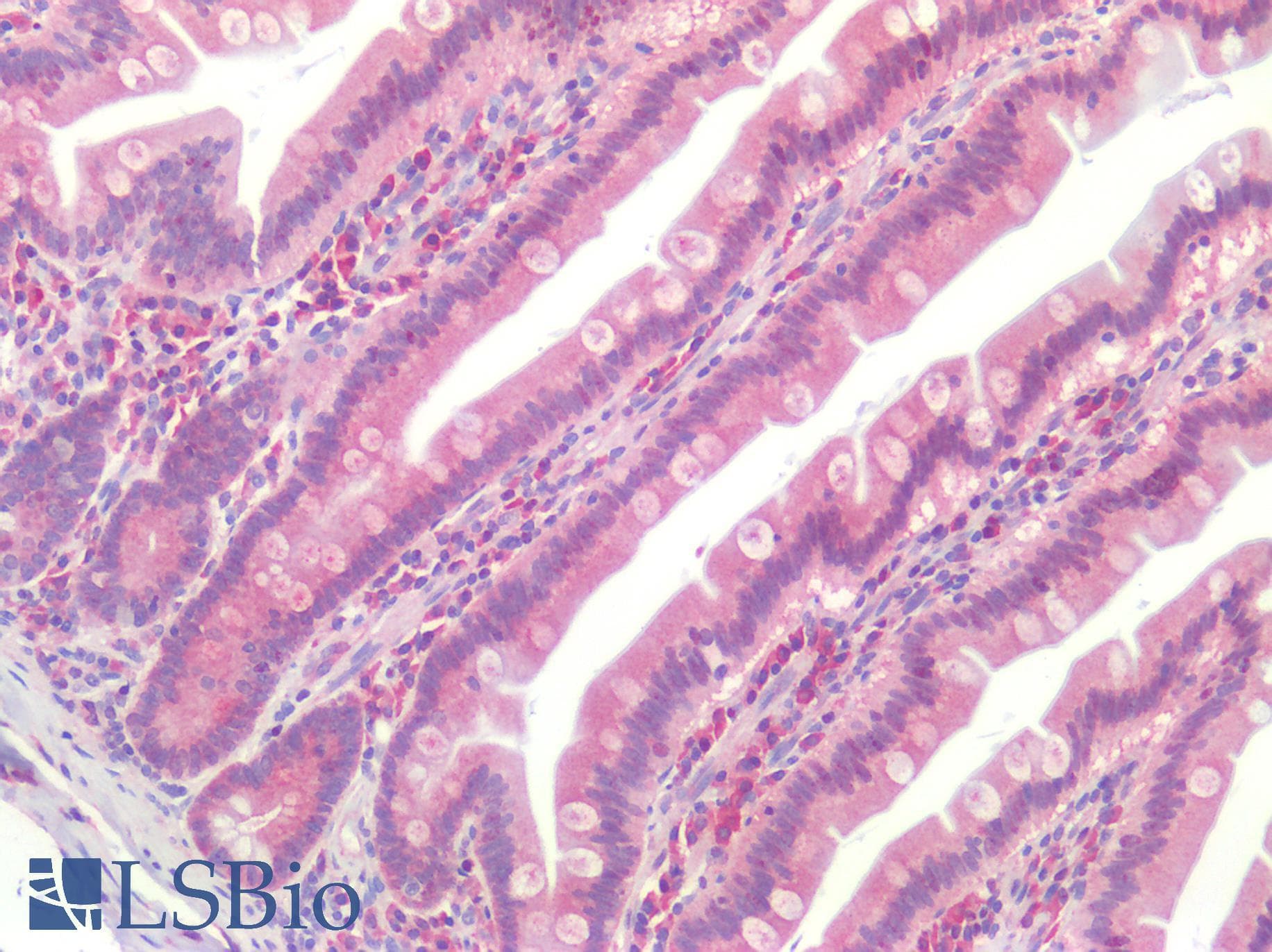 IHC-plus™ PARP1 Antibody