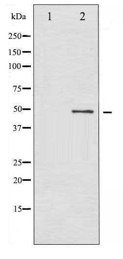 SMAD3 Antibody (phospho-Thr179)