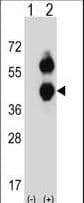BCAT2 Antibody (aa309-336)