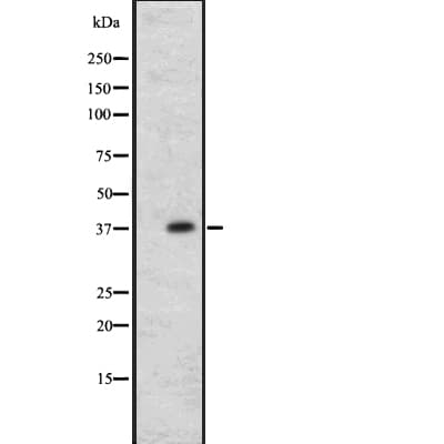 CCR1 Antibody