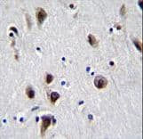 MECP2 Antibody (aa58-87)