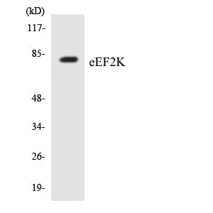 EEF2K Antibody (aa309-358)