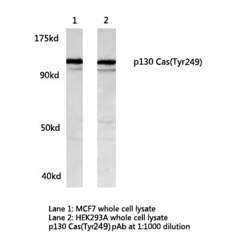 Polyclonal Rabbit anti-Human BCAR1 / p130Cas Antibody (Tyr249, WB)