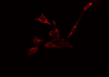 EIF5B / IF2 Antibody